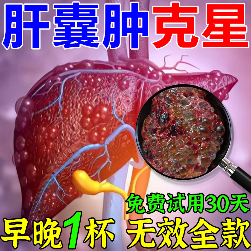 肝囊肿治疗正品的药肝血管瘤消囊去除单多发性肾胆囊息肉中药克星