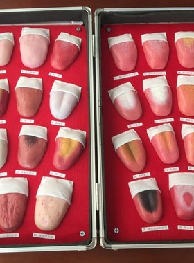 热销人体舌苔模型舌苔变化过程模型舌苔病变模型