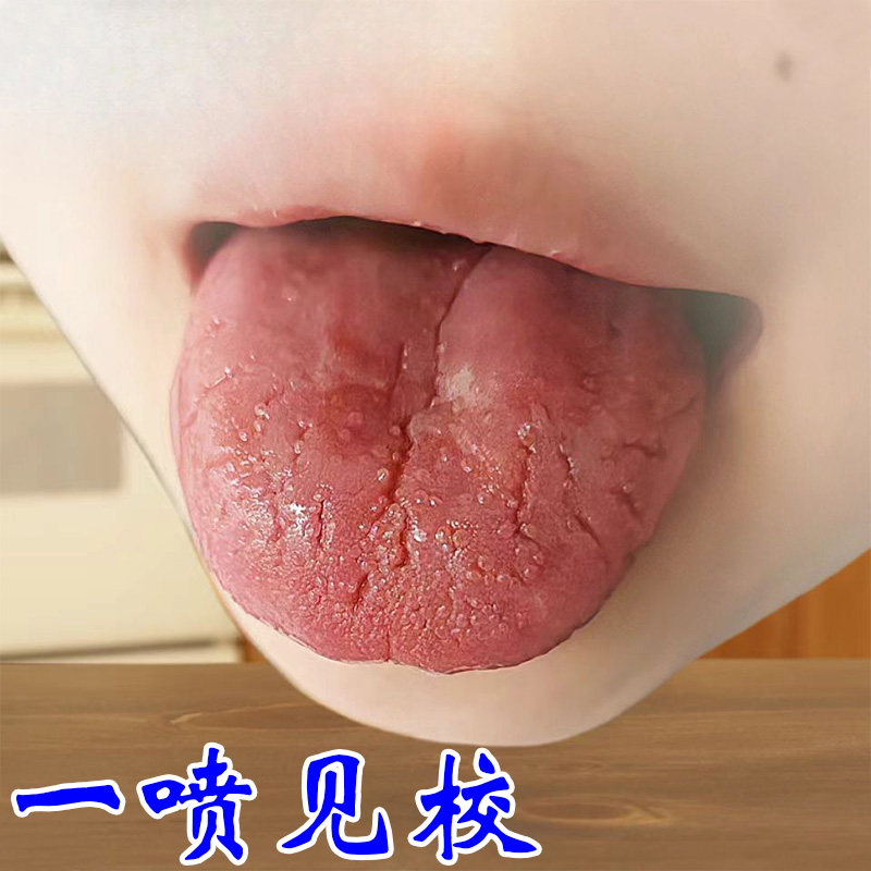 舌头裂痕地图舌裂纹舌齿痕灼口综合症舌头发白发厚麻木疼痛专用液