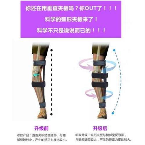 新品大腿外翻矫正器成人儿童宝宝腿型矫正带O型腿X型矫正支架腿部