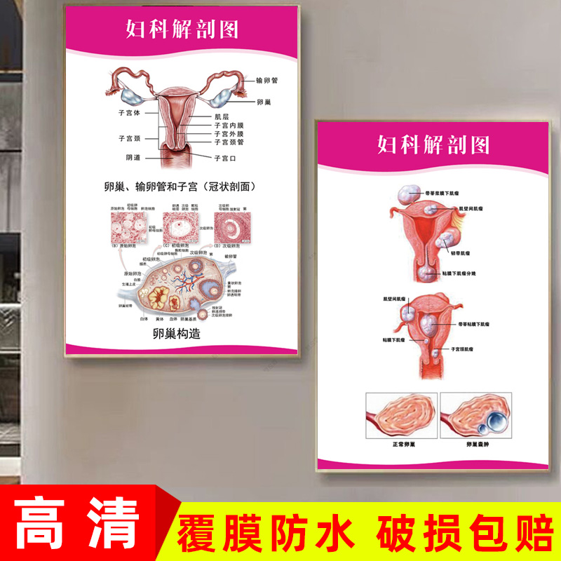 女性妇科解剖图挂画生殖系统解析挂图医院诊所子宫解剖宣传画墙贴