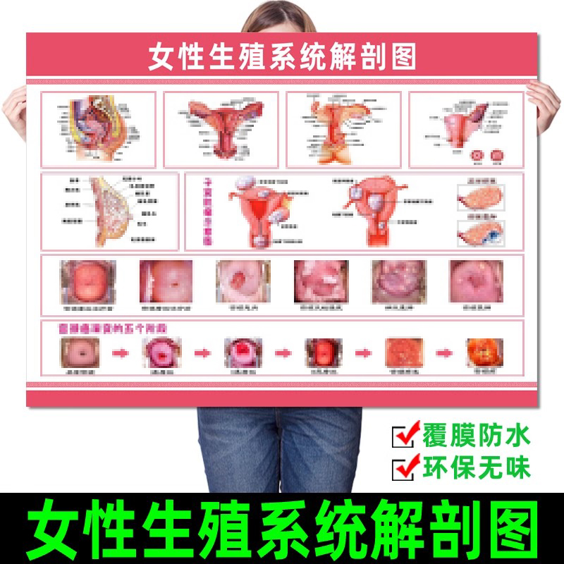 女性生殖器系统解剖图医院宣传画挂图子宫妇科海报宫颈疾病示意图