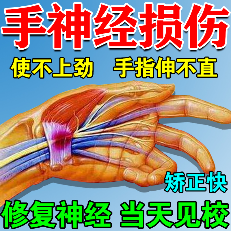手神经受损修复手指僵硬消除神器无法弯曲困难无力麻木肿胀通络膏