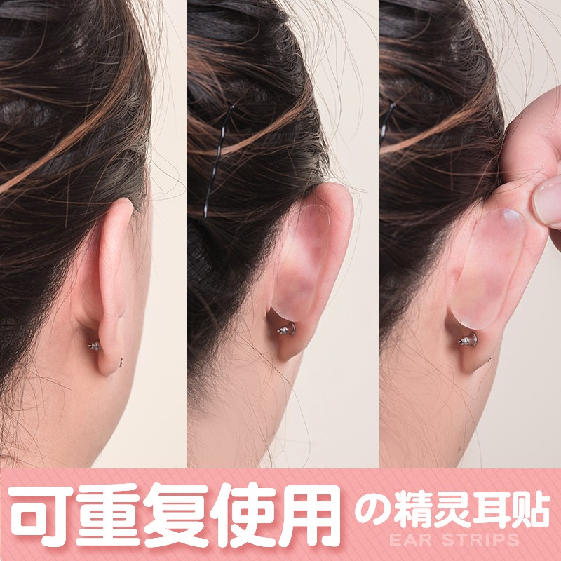 精灵耳贴器硅胶固定反复使用变招风耳硬贴面耳立耳矫正撑耳朵隐形