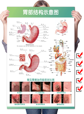 胃部结构系统示意图医学宣传挂图人体器官解剖图医院肠胃疾病海报