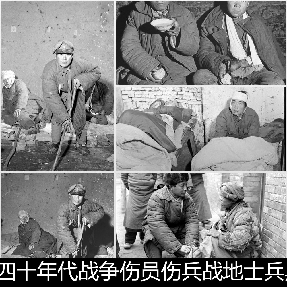 EMP二十世纪四十年代战争伤员伤兵战地黑白老照片非高清小图素材
