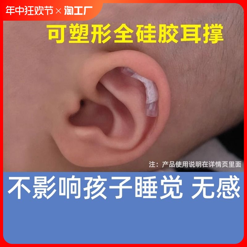 婴儿耳廓矫正器宝宝耳朵定型贴招风耳新生儿硅胶带耳畸形耳撑垂耳