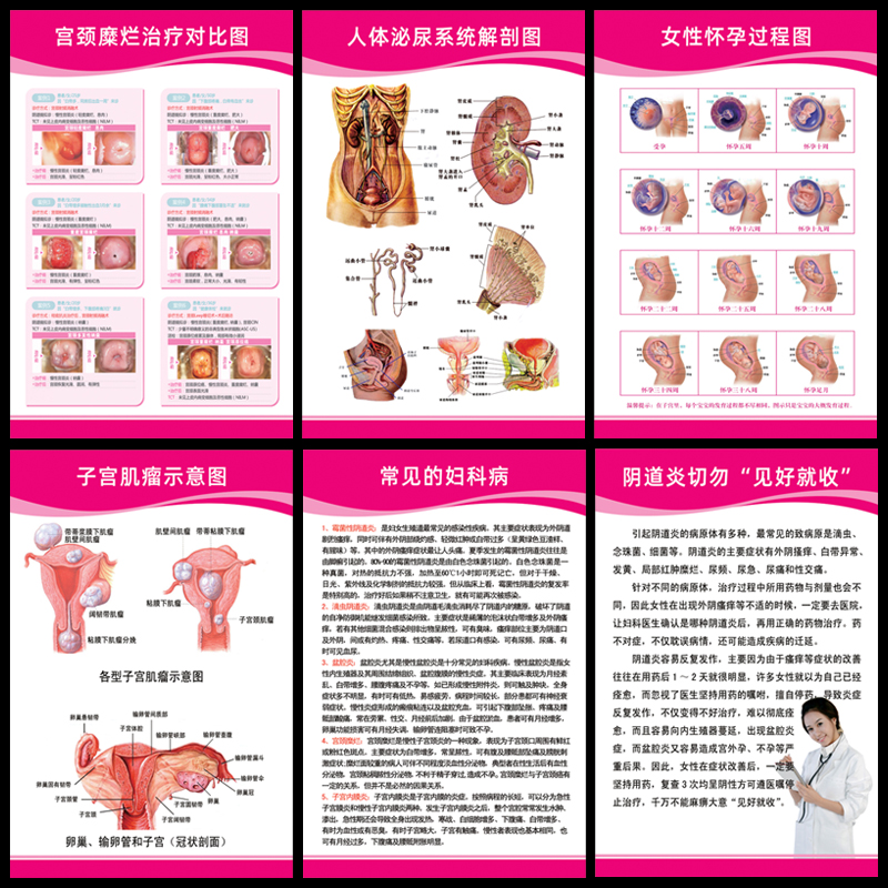 医院妇科健康知识宣传画妇科疾病对应症状女性生殖器系统解剖挂图