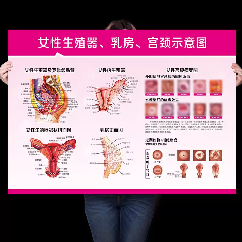 宫颈疾病示意图女性泌尿生殖系统解剖妇科人体器官挂图海报宣传画