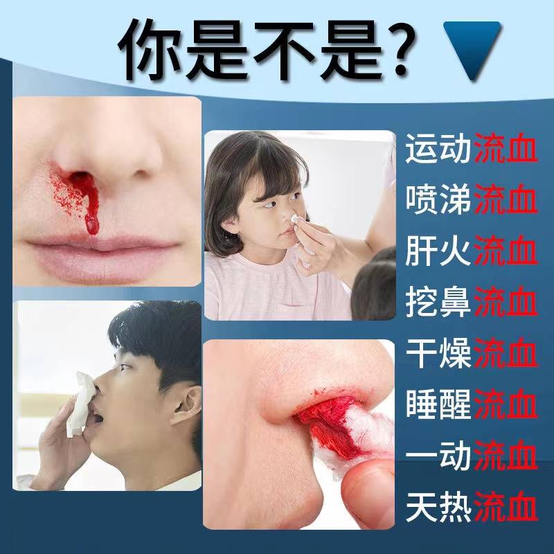 速发鼻子出血流鼻血专用修复鼻黏膜治疗小孩子经常流鼻血保湿止血
