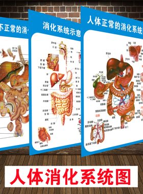 不正常消化肠道系统结构示意图医学宣传挂图人体器官医院布置海报