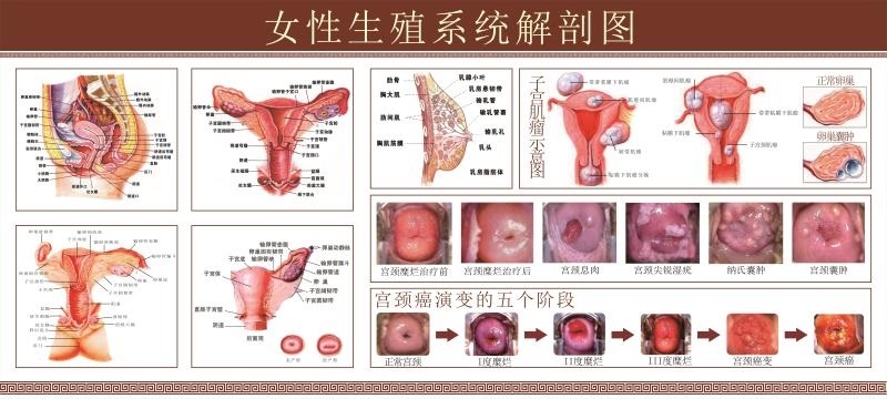 女性生殖器系统解剖图医院宣传画挂图子宫妇科宫颈疾病示意图海报