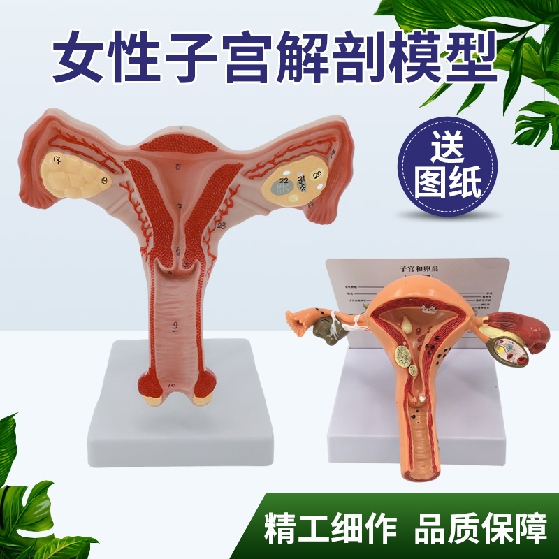 仿真人体子宫模型卵巢常见病模型 女性生殖系统计生模型 教学医学